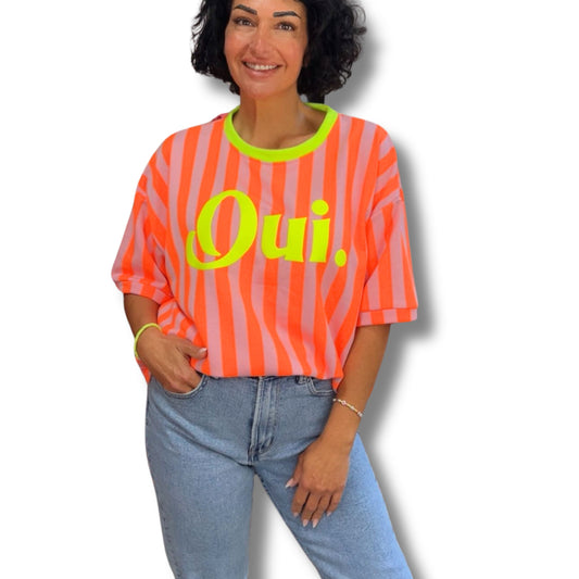 Oversize Shirt Oui – Detailansicht Print und Streifenmuster