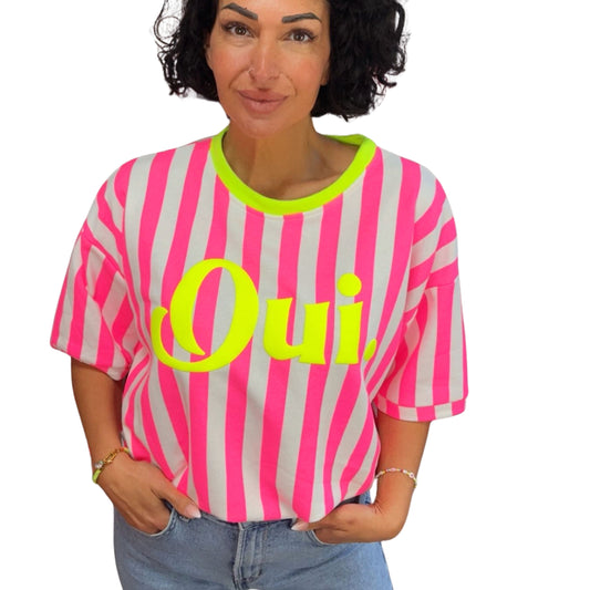 Oversize Shirt Damen – Rückenansicht, lässiger Sommer-Look